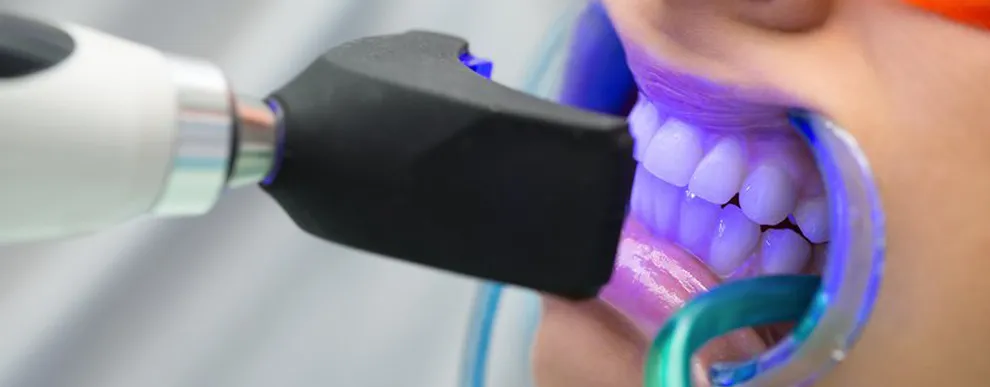 dentist-grade-teeth-whitening